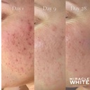 miracle-white-beauty-glow-6.jpg