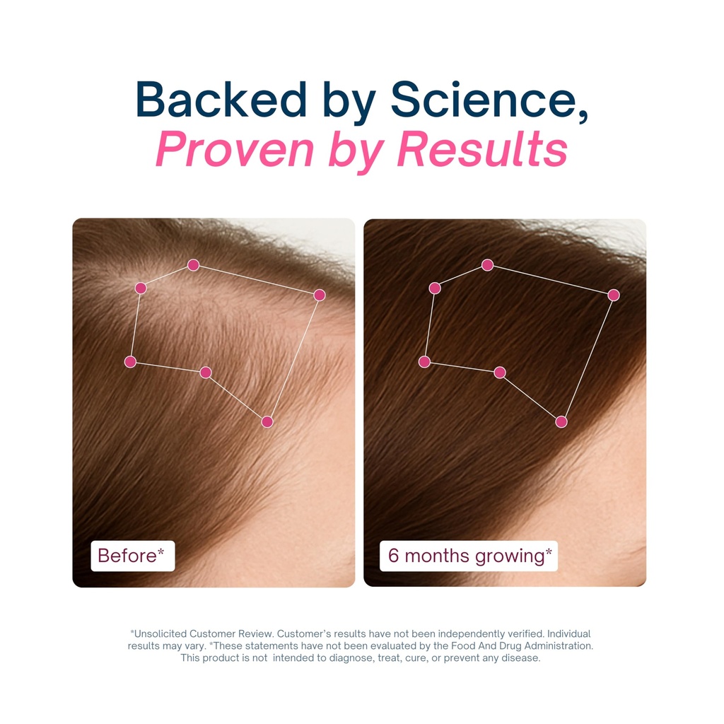 hair-growth-supplements-nourishes-thinni-5.jpg
