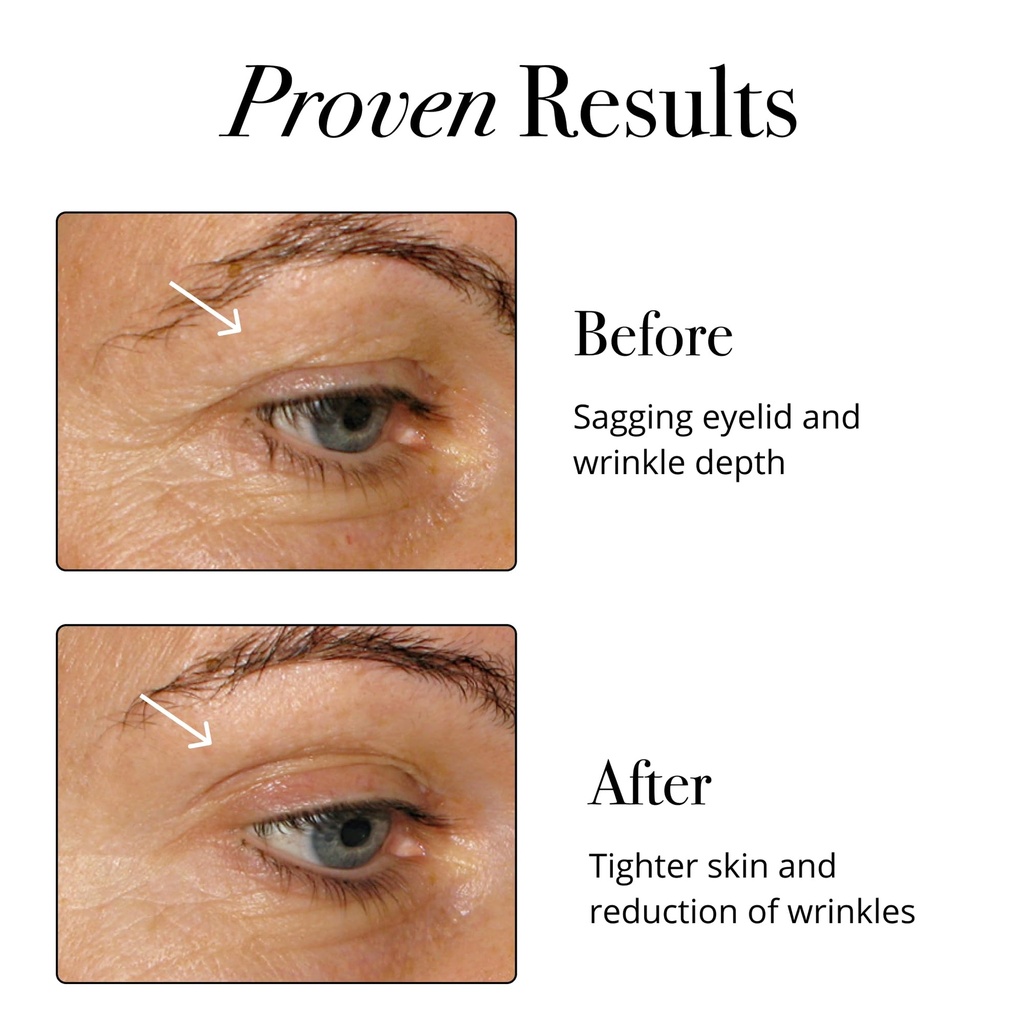 glotrition-super-beauty-elixir-collagen--2.jpg