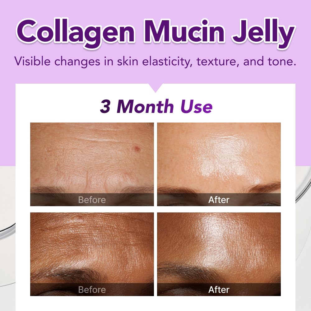 glow-1200mg-snail-mucin-supports-skin-el-2.jpg