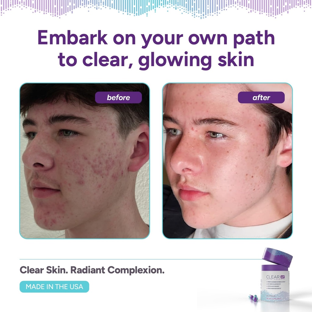 clear-skin-supplement-skin-barrier-hydra-3.jpg