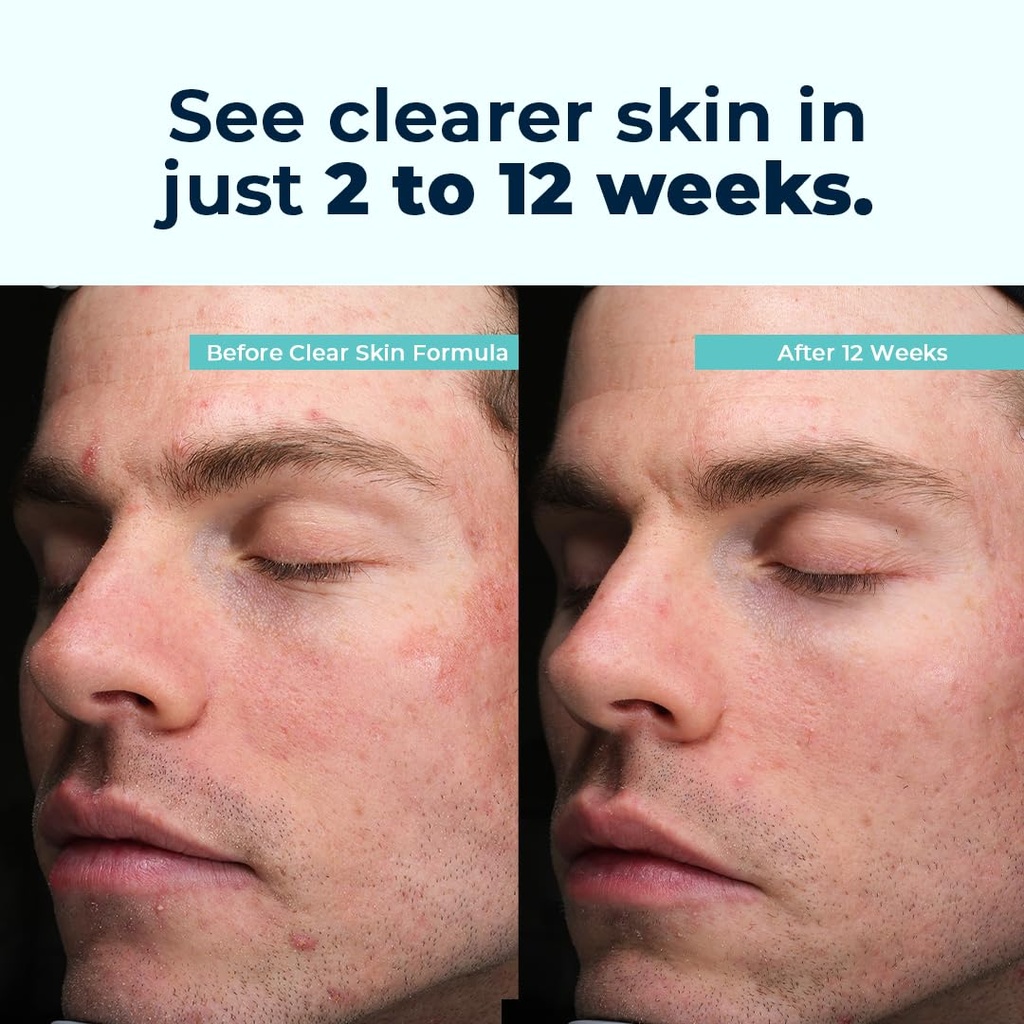 vitamedica-clear-skin-vitamin-formula-no-4.jpg