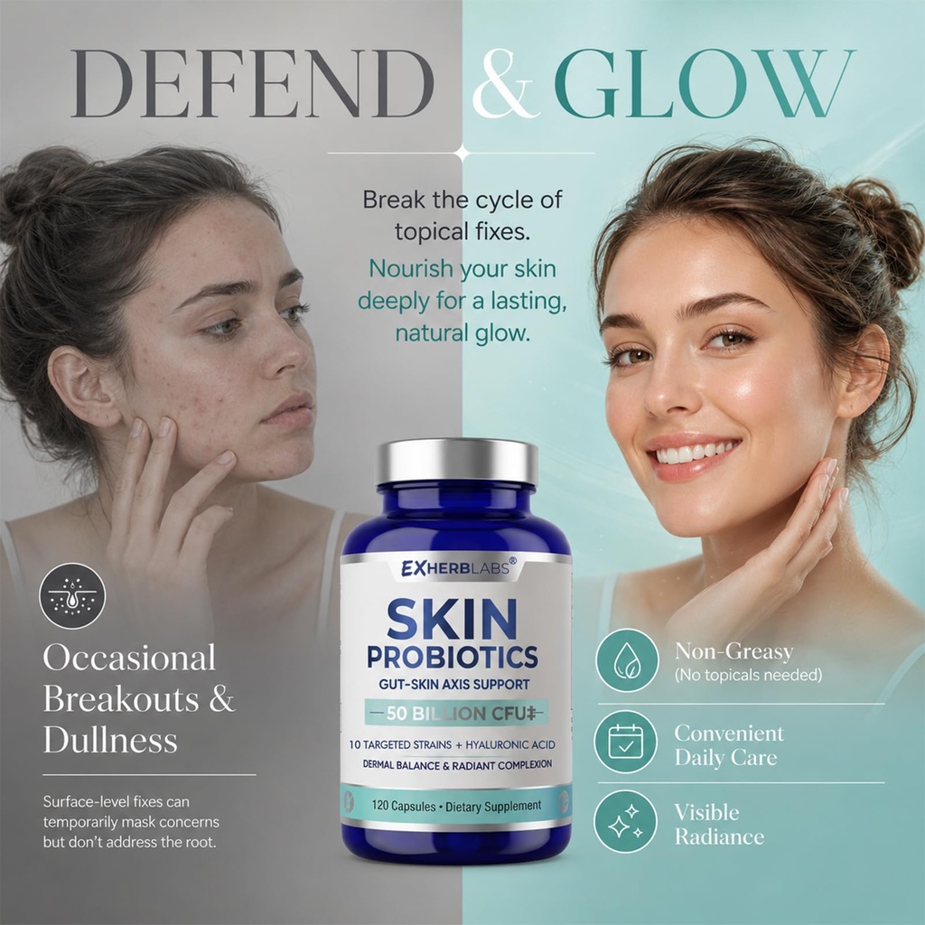 skin-probiotics-supplement-gut-skin-care-71ul2WuYstL.jpg
