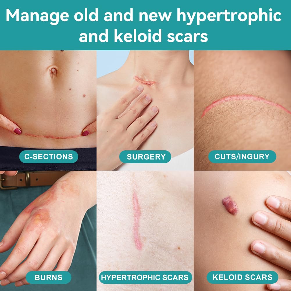 dimora-hydrocolloid-wound-dressing-silic-6.jpg