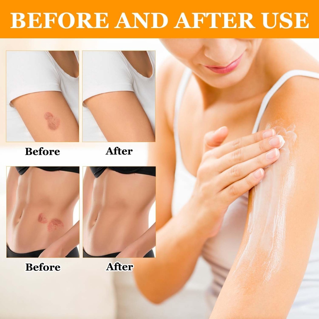 bee-venom-correcting-cream---3-bottle-se-6.jpg