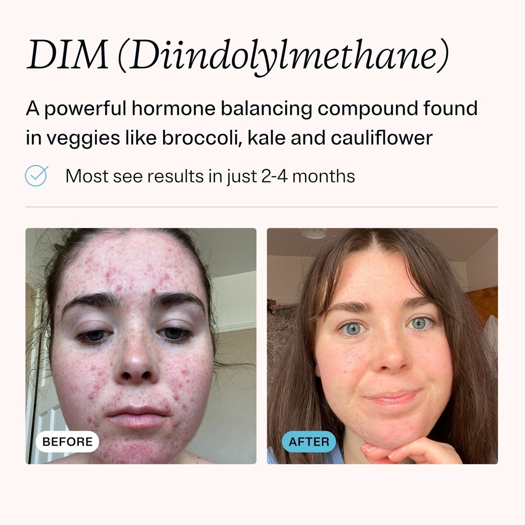 mdacne-dim-skin-clearing-supplements-30--3.jpg