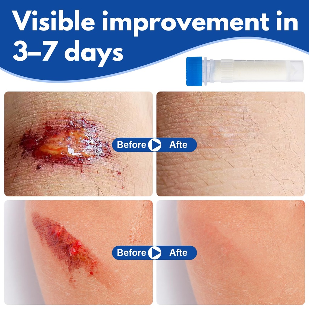 collagen-powder-for-wounds-medical-grade-3.jpg