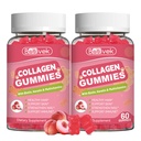 Collagen Gummies for Women & Men - Hydrolyzed Collagen Peptides Type I II III V X | 120 Cts with Biotin, Hyaluronic Acid & Vitamins C D B12 A E
