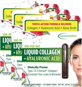 Angewandte Ernährungsflüssigkeit Kollagen + Hyaluronsäure - 10 Flüssigkeitsrohre, Packung mit 3 - Haut- und Nagelrestauration - Gemischte Beerenschlamm - 30 Portionen
