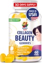 SUNNY SAM Biotin Collagen Gummis für Damen und Mädchen - Niedriger Zucker 60 Kaubare Schönheit Collagen Gummis für verbesserte Haar Haut und Nägel - Biotin, Vitamin A, Zink-Ergänzung - Natürliche Zitronen Geschmack