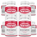 Akne Pillen Supplement- Klare Haut Vitamine Pille für ölige Haut Behandlung, Hormone Blemishes, Anti Spots & Cystic Aknes Ergänzungen für Frauen, Männer, Teenager & Erwachsene- 240 Oral Tablets