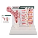 Ultrassist Human Anatomie Osteoporosis Modell, Vertebrae Anatomisches Skelettmodell mit Studienkarte für medizinische Studenten Vorführung