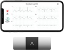 AliveCor KardiaMobile 6-Lead Personal EKG Monitor – Sechs Ansichten des Herzens – Erkennt AFib und unregelmäßige Arrhythmien – Instant Results in 30 Sekunden – arbeitet mit den meisten Smartphones