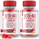 NutraRize (Pack mit 2 KetoKandies Keto+ACV Gummis für Gewichtsverlust, maximale Festigkeitsergänzung, Keto Kandies Bewertungen (120 Gummi)